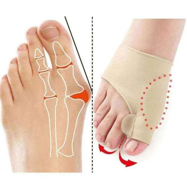 Corretor de Joanete Silicone - Meia Ortopédica - Vida Eficaz