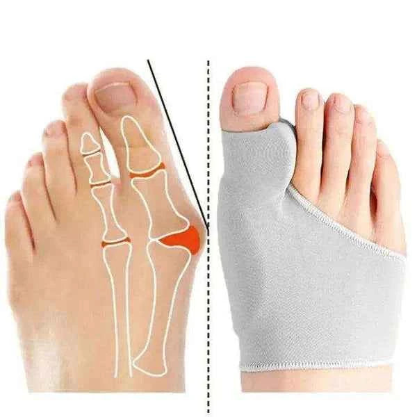 Corretor de Joanete Silicone - Meia Ortopédica - Vida Eficaz